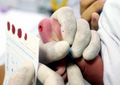Hospital Iguassú realiza mais de 4,5 mil testes do pezinho e reforça importância do exame neonatal